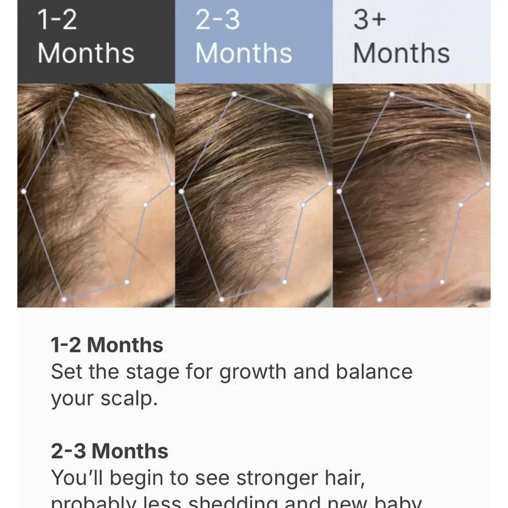 Superpower Thickening Hairpatches - Gold